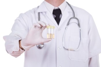 doctor’s hand holding a bottle of urine sample