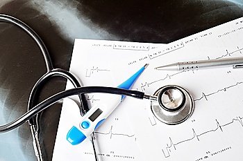 stethoscope on  printout of  heart monitor -blue tint