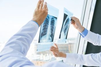 Doctors discuss x-ray. Group of doctors look and discuss x-ray in a clinic or hospital