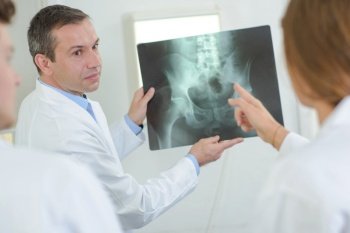 Doctor showing xray of pelvic area