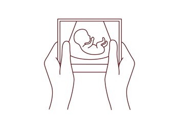 Hands of person holding scan of embryo waiting for baby birth. Future mother with ultrasound picture of baby. Motherhood concept. Vector illustration.. Future mother hold scan of embryo