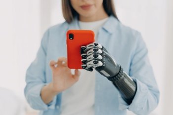 Young woman with bionic arm texts on smartphone. Attractive Caucasian with modern prosthesis at home.