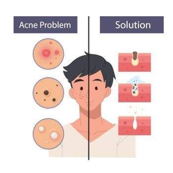 Face Care Men concept. Facial care, skin defects, skin problems, acne, facials. Facial care icons. 