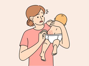 Anxious young mother confused with newborn baby body rash. Worried mom scared about child infant skin allergy. Motherhood, infantry healthcare. Vector illustration. . Anxious young mother confused with baby body rash