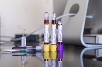 Blood tubes used in vaccine studies on the table