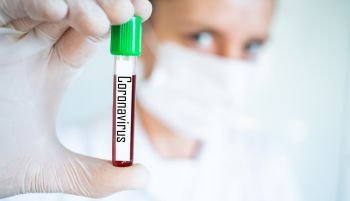 female doctor holding a blood test sample coronavirus