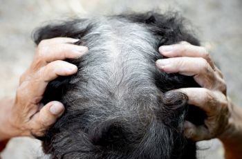 The head of an old woman with many gray hair.