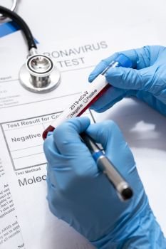 corona virus coronavirus rapid test