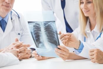 Group of doctors look and discuss chest x-ray in a clinic or hospital. Group of doctors discuss x-ray