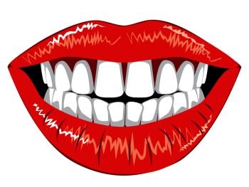 Red smiling female lips with white teeth on white background.