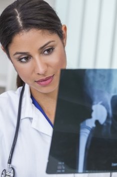 A Latina Hispanic female medical doctor surgeon looking at hip replacement x-ray in a hospital