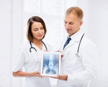 healthcare, medical and radiology concept - two doctors showing x-ray on tablet pc