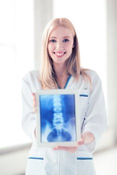 bright picture of female doctor with x-ray on tablet pc. female doctor with x-ray on tablet pc