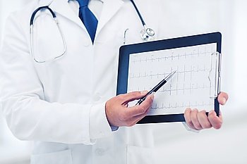 healthcare and medical concept - male doctor hands holding cardiogram. male doctor hands holding cardiogram