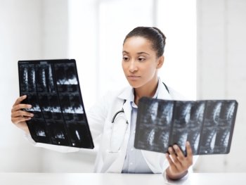 healthcare, medical and radiology concept - african doctor looking at x-rays