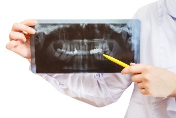 nurse holds X-ray picture with human jaw isolated on white background